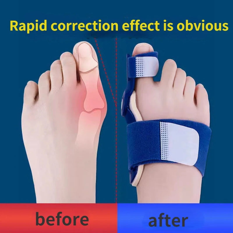 Bunion Corrector for Toe Pain Relief